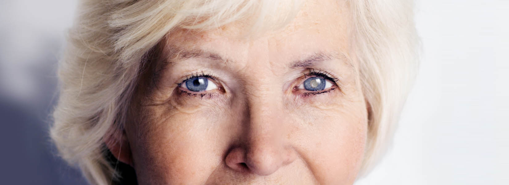 Cataract Surgery in Amite City